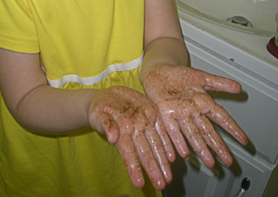 germs