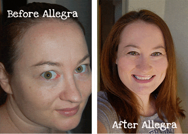 beforeafter2